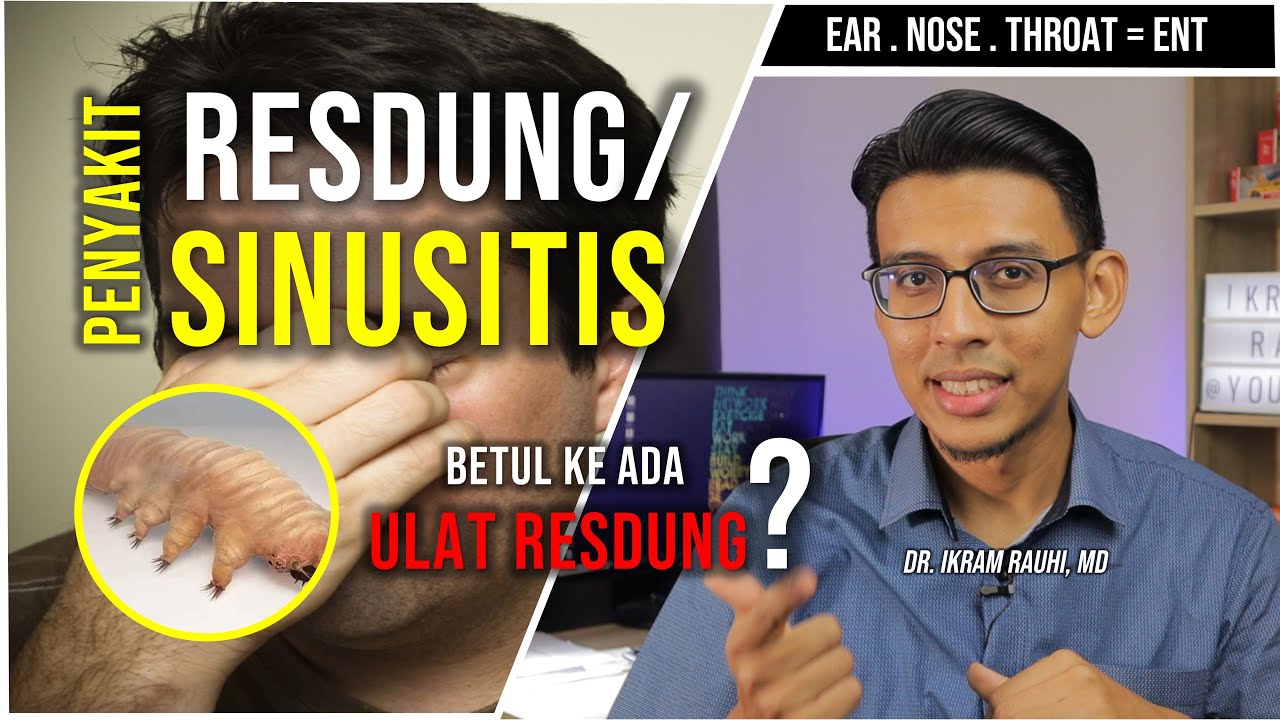 Sinusitis (Resdung) - Apa Yang Anda Perlu Tahu? Rawatan Keluarkan Ulat Resdung.