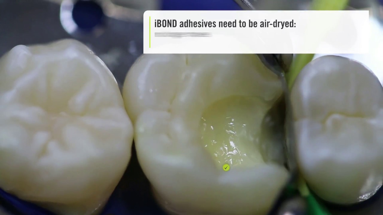 5 Tips For Successful Bonding