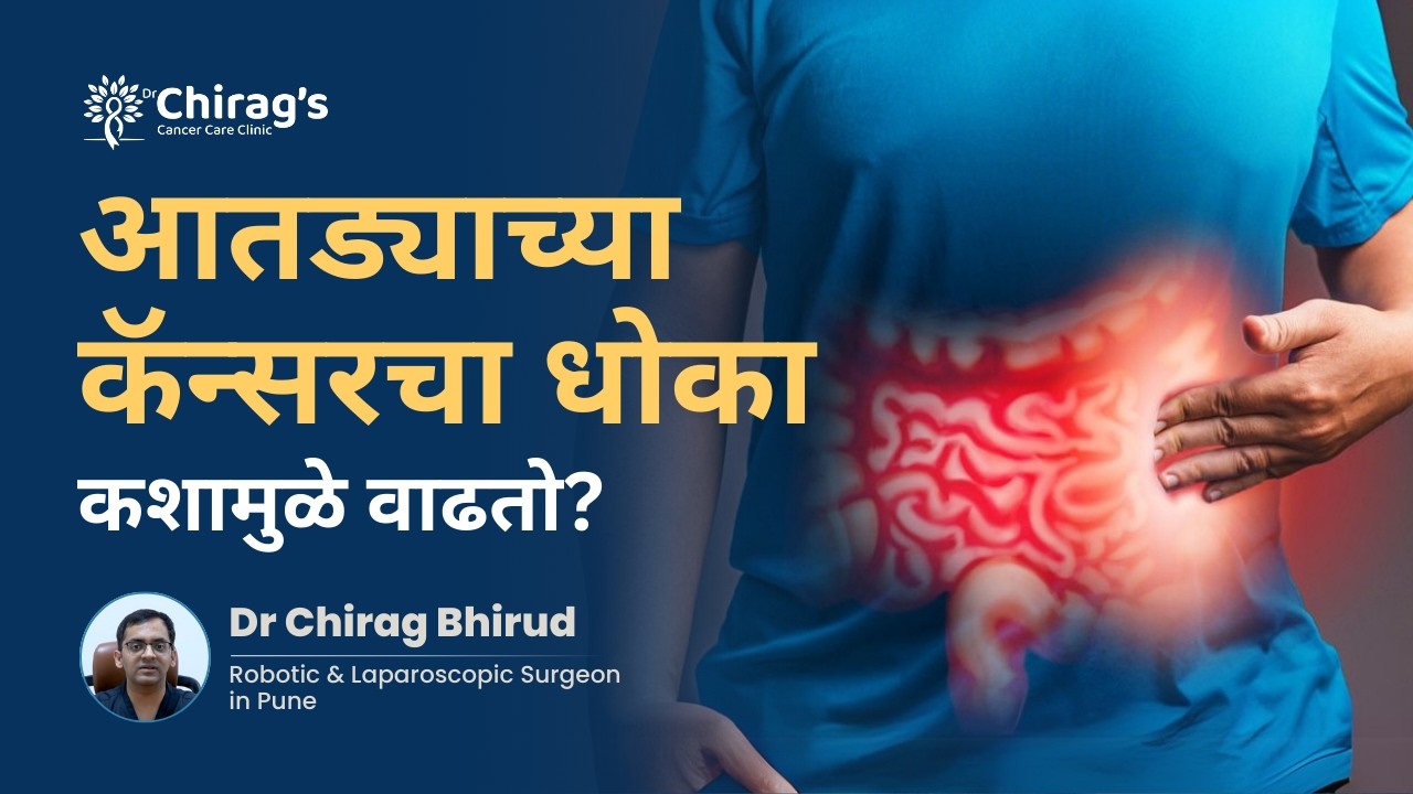 आतड्याच्या कॅन्सरचा धोका कशामुळे वाढतो? | What Are the Risk Factors for Colon Cancer? | Dr. Chirag