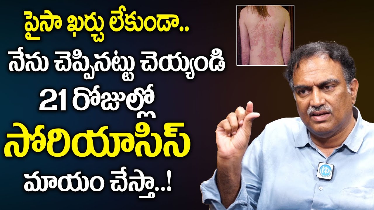 ఇలాచేస్తే సోరియాసిస్ మటుమాయం | Psoriasis Treatment | in Telugu | Dr Veeramachaneni Diet || iD Health
