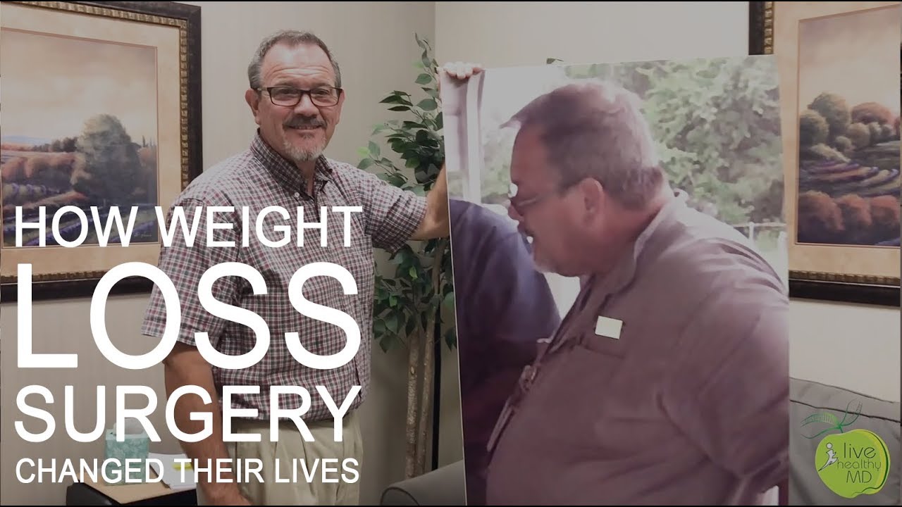 Tony's Weight Loss Surgery Experience
