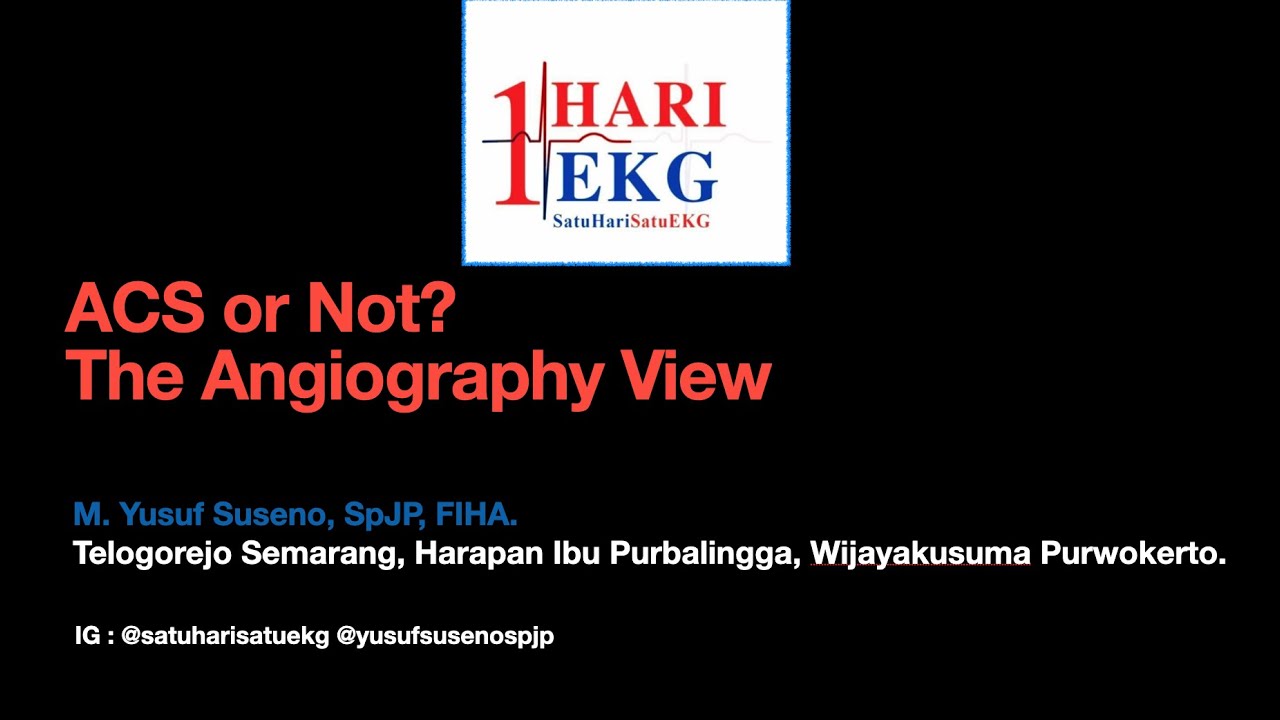 ACS or NOT? STEMI or NOT? Bagaimana Cara Mengenali SUBTLE STEMI?
