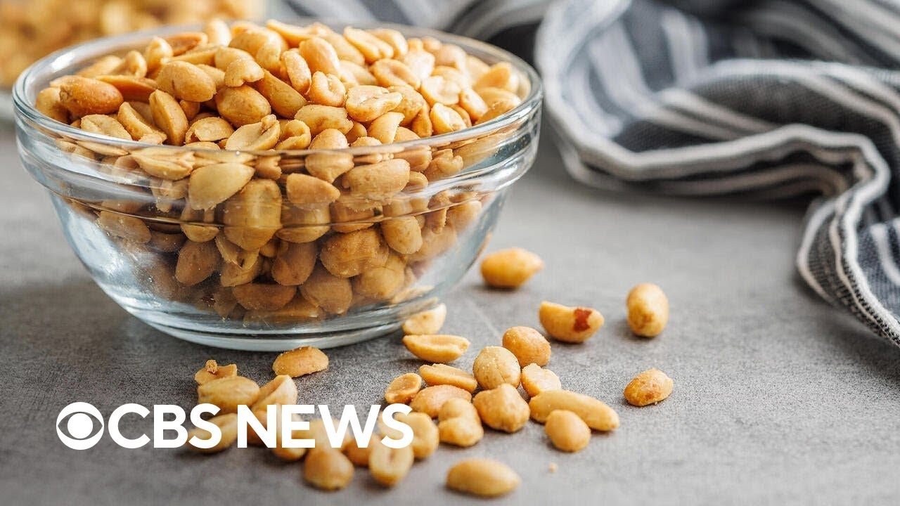 Peanut allergies in kids decline 10 years after experts recommend early infant exposure, study finds