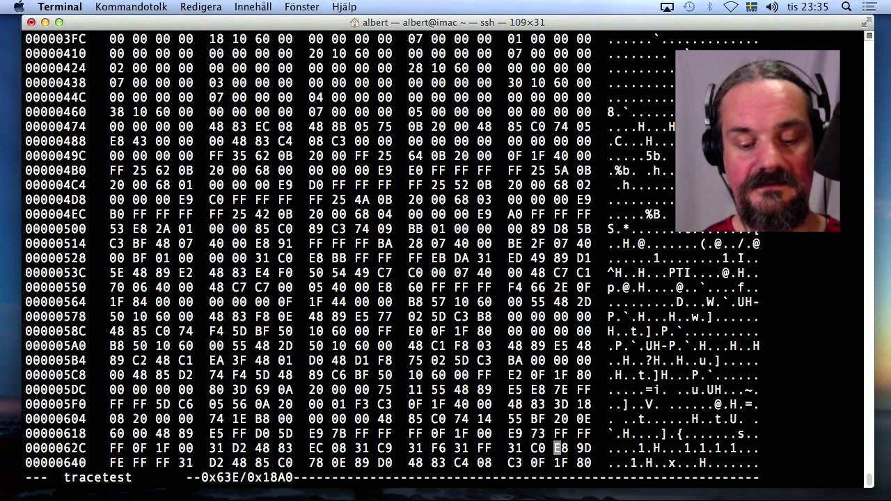 Linux basic anti-debug