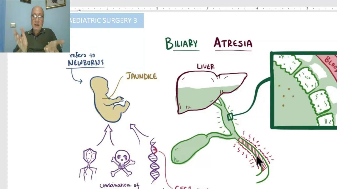 Paediatric surgery in Arabic 13 ( Biliary Atresia) ,  by Dr, Wahdan