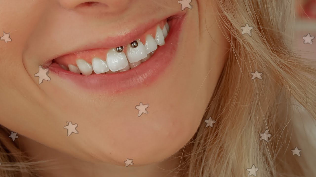 MON PIERCING SMILEY : douleur, prix, exp&eacute;rience..