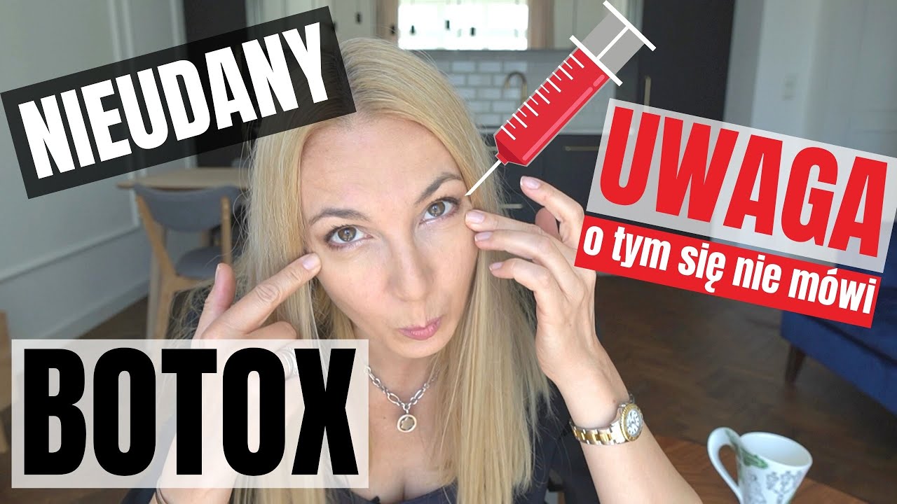 NIEUDANY BOTOX 💉 BOTOKS POWIKŁANIA 🤦‍♀️MEDYCYNA ESTETYCZNA 😤 JESTEM OSZPECONA 🤭 KOBIETA KOT