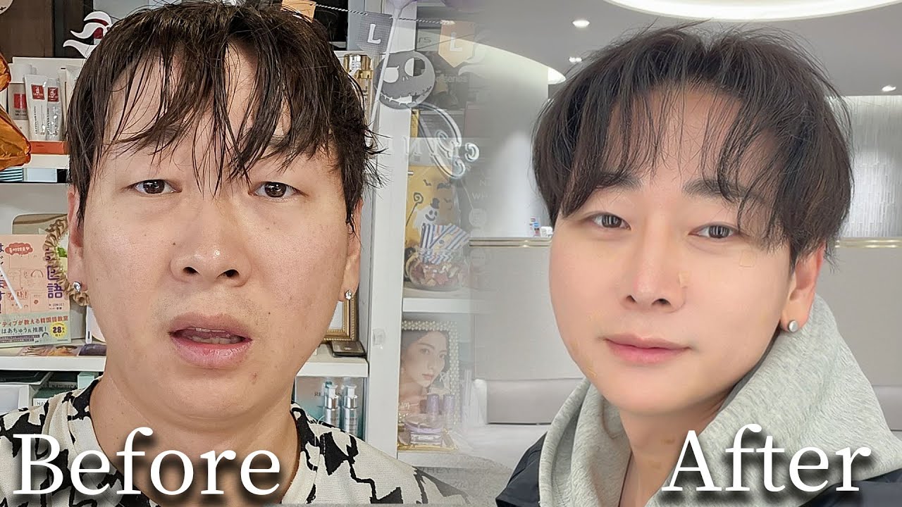 自分の顔にやるならこれ！私がこんなに変わるまでやった整形施術