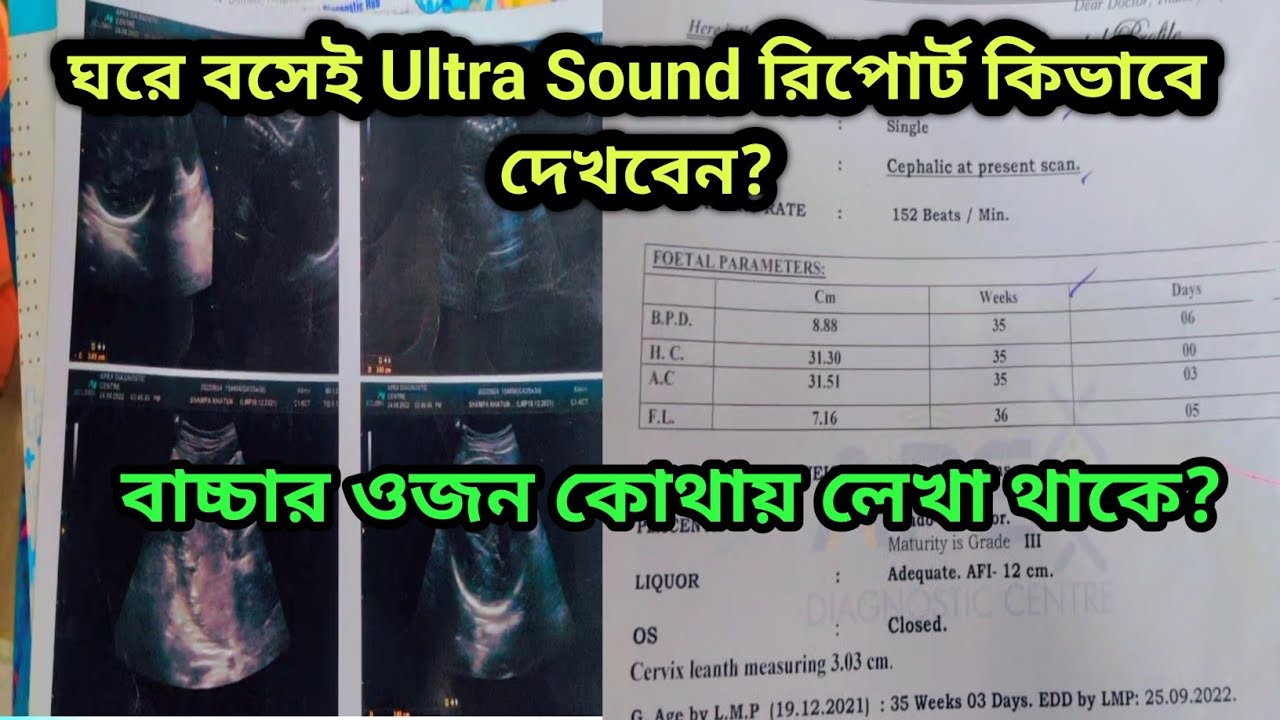 আল্ট্রাসাউন্ড রিপোর্ট নিজেই দেখতে পারবেন কি ভাবে ? বাচ্চার ওজন কোথায় লেখা থাকে।