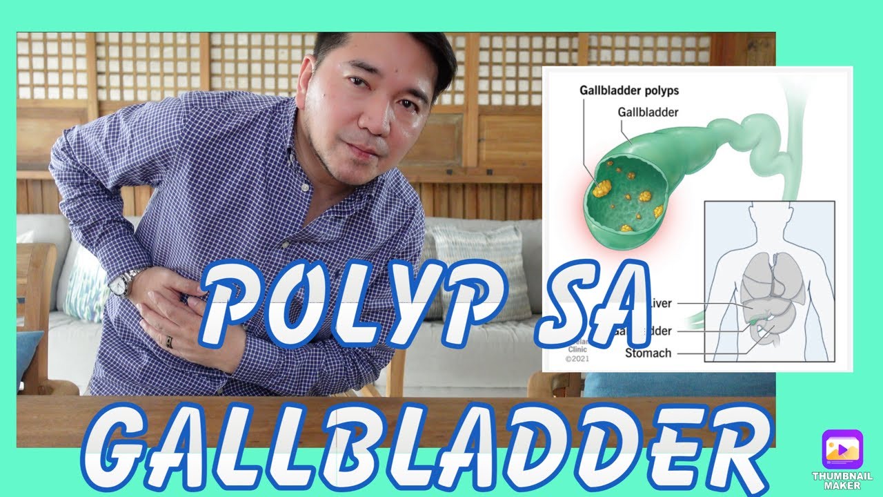 DELIKADO BA? ANO ANG GAMOT?