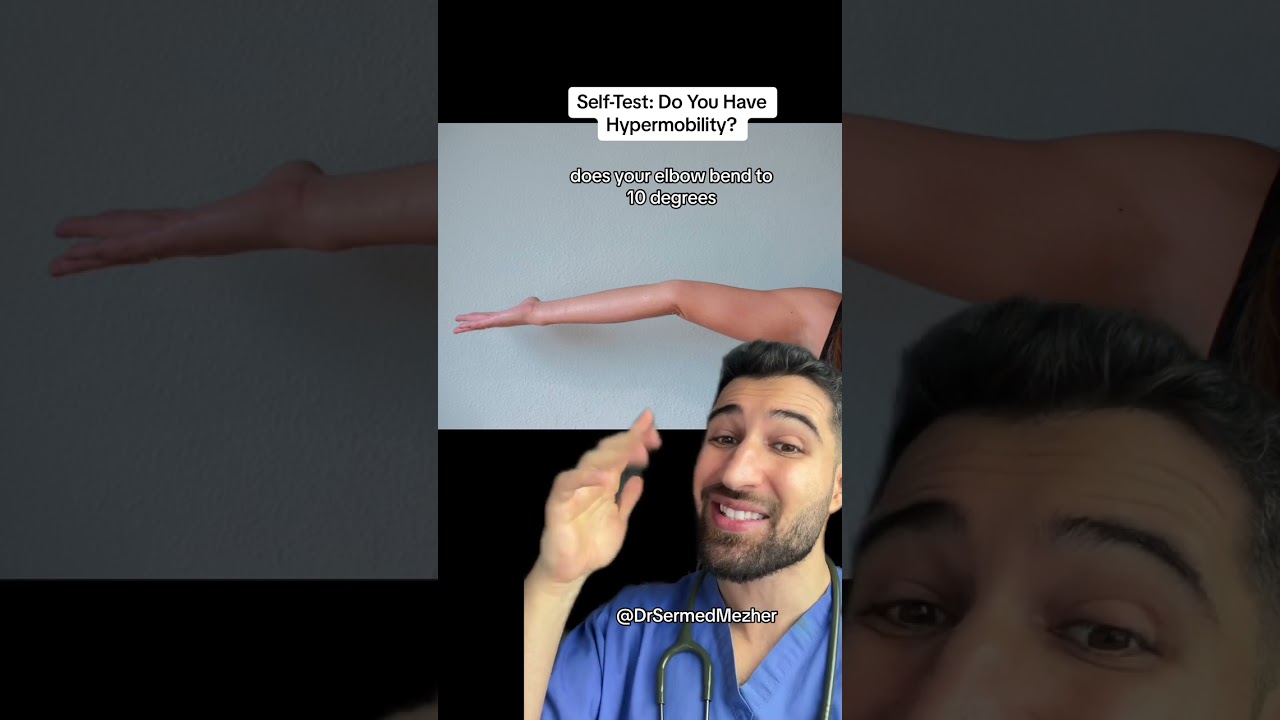 Self-Test: Do You Have Hypermobility? #joints