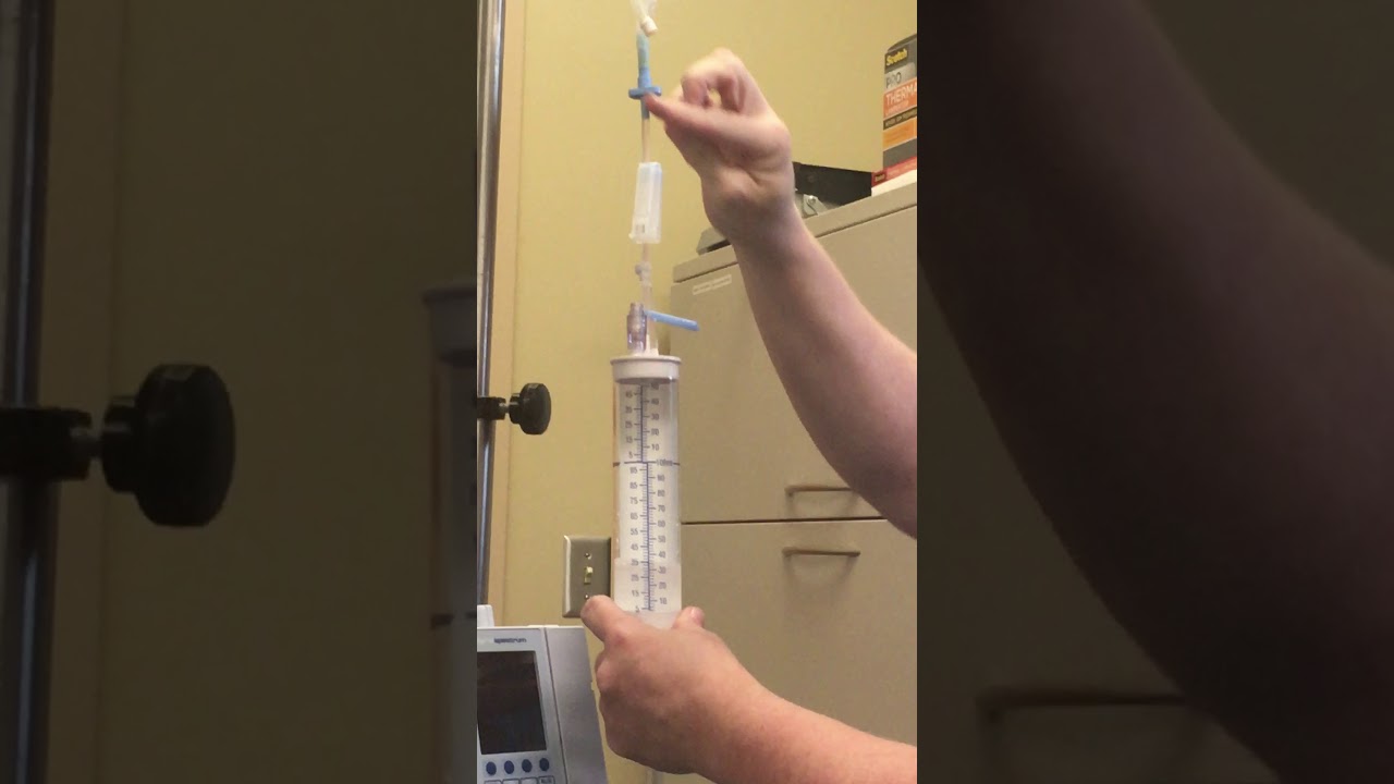 Priming the Buretrol (OSCAR)