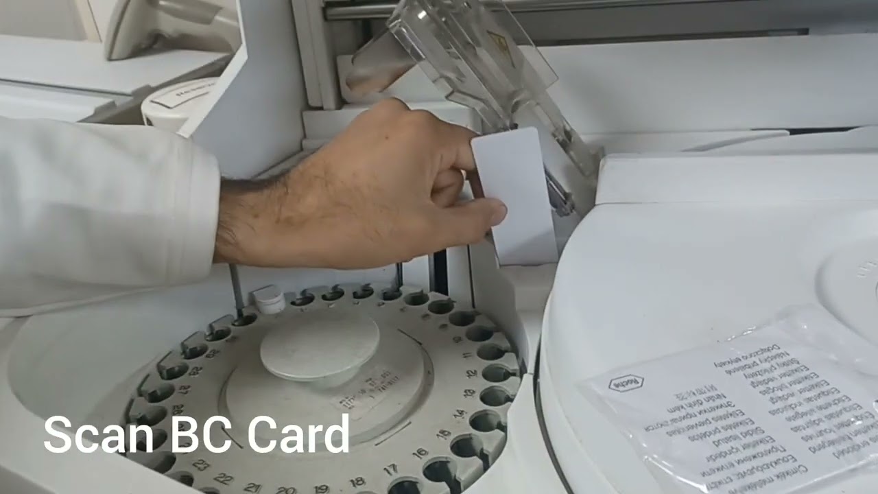 Calibration Cobas e 411 BHCG level
