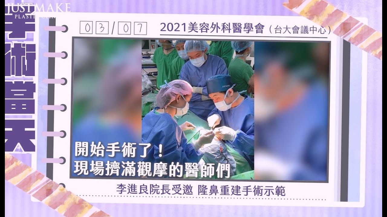 【嘉仕美】李進良院長受邀示範 #隆鼻重建手術