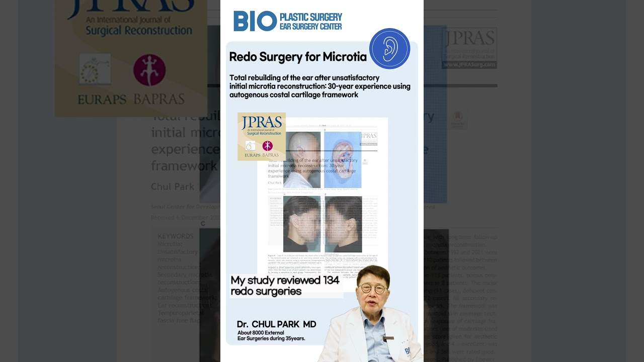 Redo Surgery for Microtia