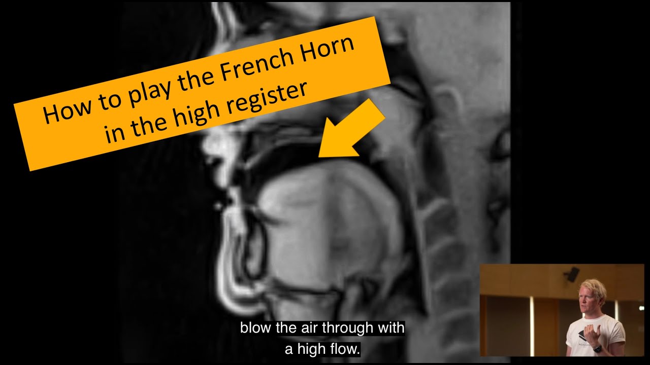 French Horn lessons and fundamentals - Thoughts on 