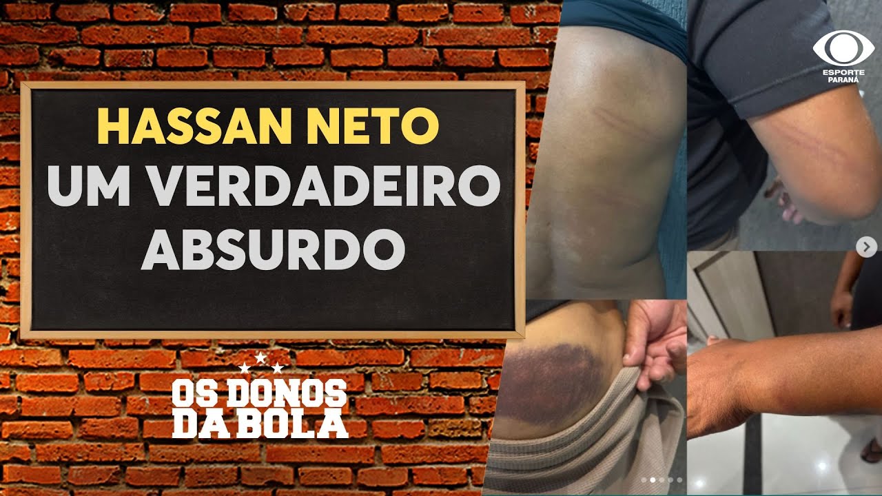 Hassan Neto critica agressão a Perdigão após jogo no Paranaense