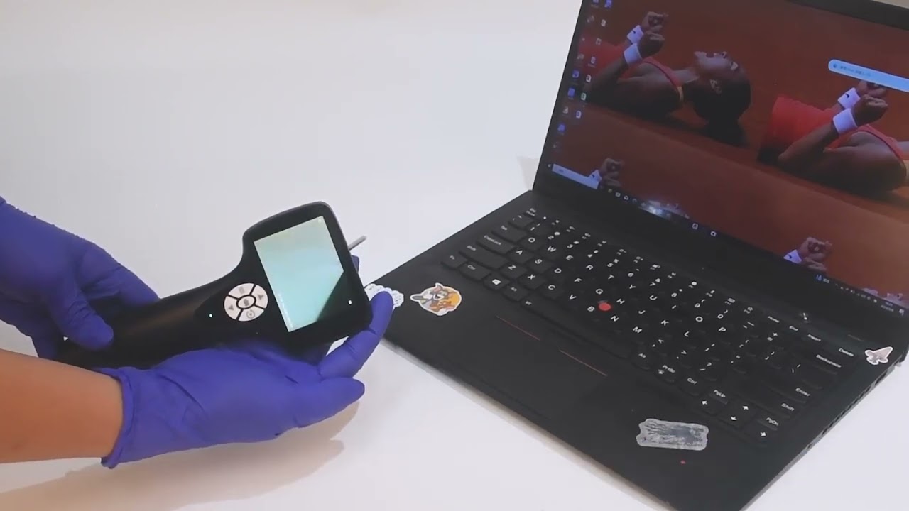 Đèn soi tai có camera VOT 02 Video Otoscope