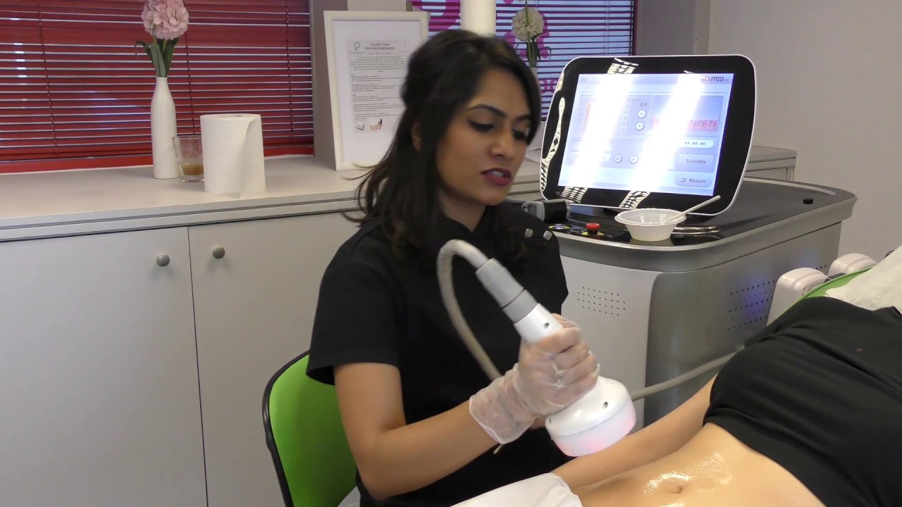 Radio Frequency Skin Tightening - Stomach