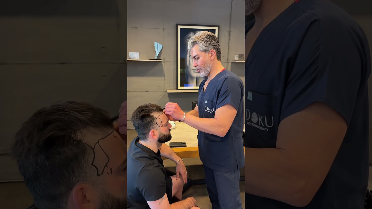 Consultation with Dr.Serkan Aygın 💪🏻😎 #drserkanayginclinic #hairtransplant #fyp #shorts