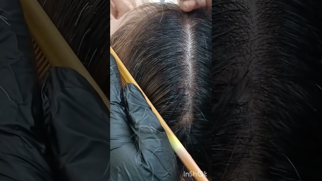 #выщипываниеседыхволос
