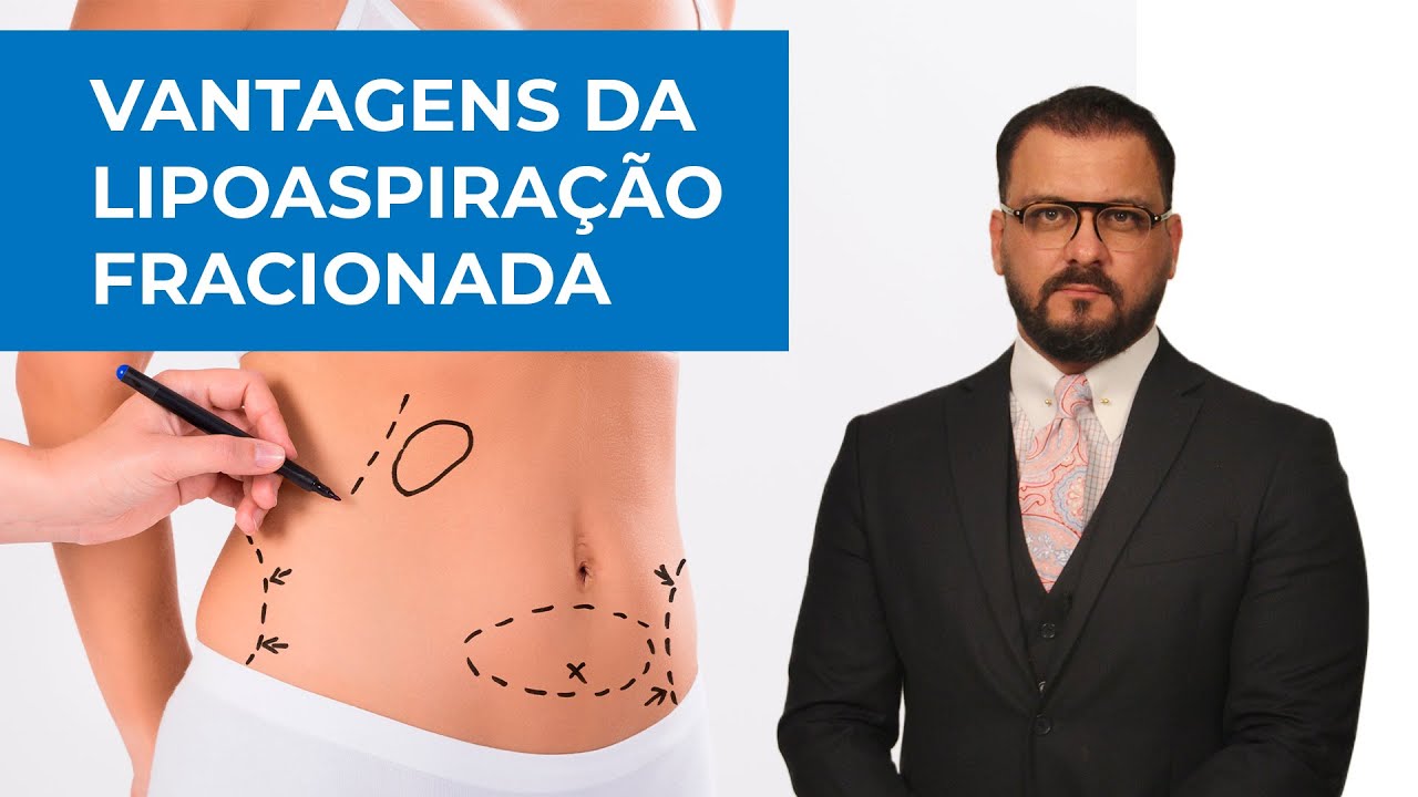 Vantagens da lipoaspiração fracionada