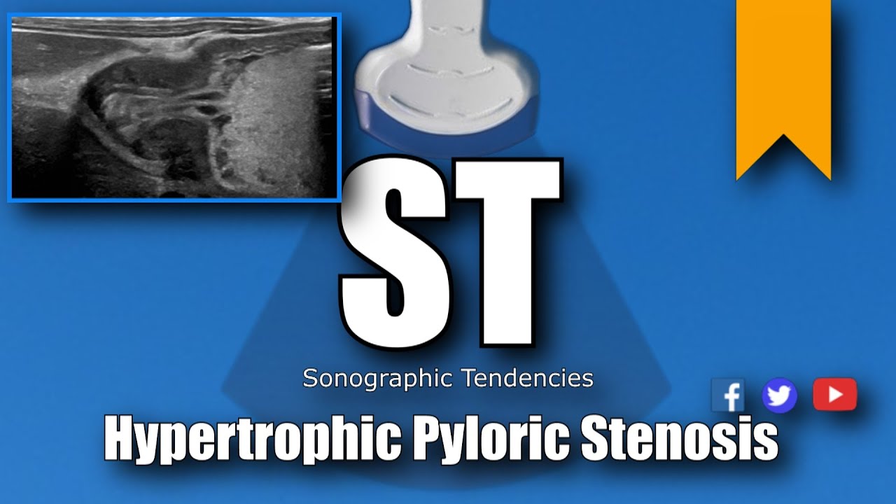 Pyloric Ultrasound
