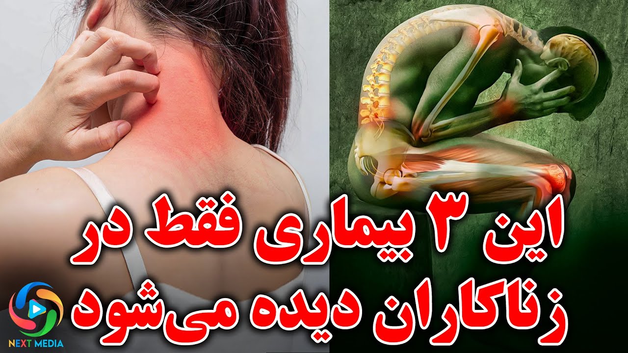 این 3 بیماری فقط در زناکاران دیده می‌شود