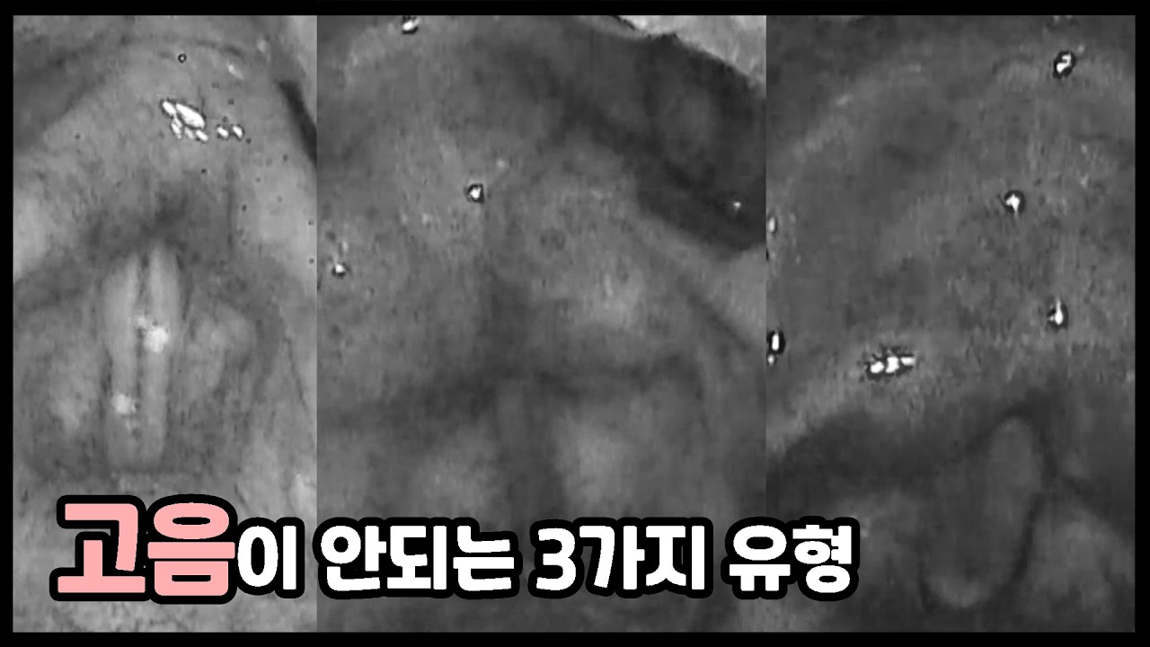 소리로 구분하는 고음불가 유형