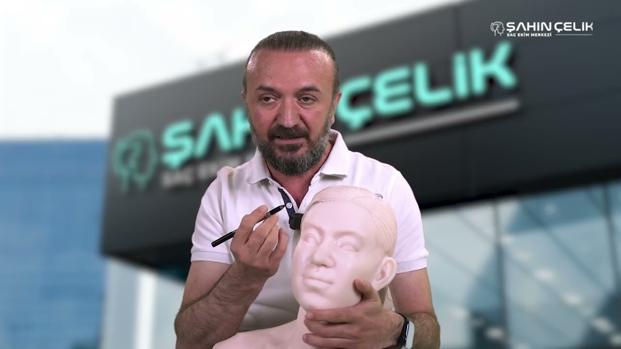 Sahin Çelik Saç Ekim Merkezi DAHA ÖNCE SAÇ EKİMİ YAPILMIŞ SAÇ ÇİZGİSİ DÜZELTİLERBİLİRMİ ?