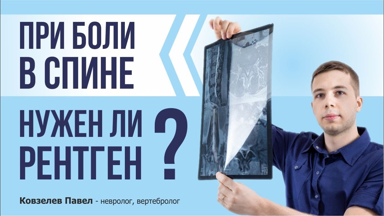 РЕНТГЕН не нужен при боли в спине? Разбираемся в вопросе с неврологом