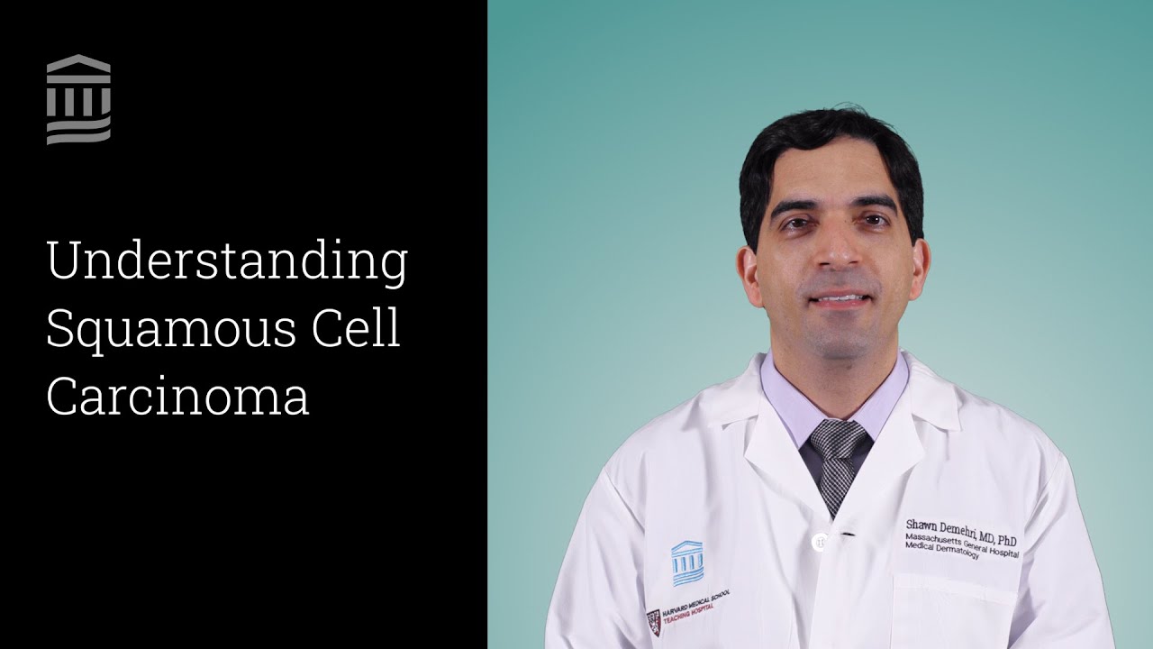 Squamous Cell Carcinoma: Symptoms, Diagnosis, Treatment | Mass General Brigham