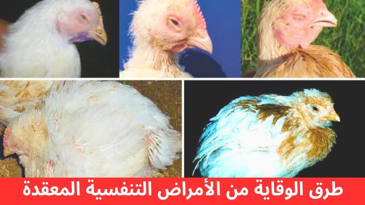 طرق الوقاية من الأمراض التنفسية المعقدة