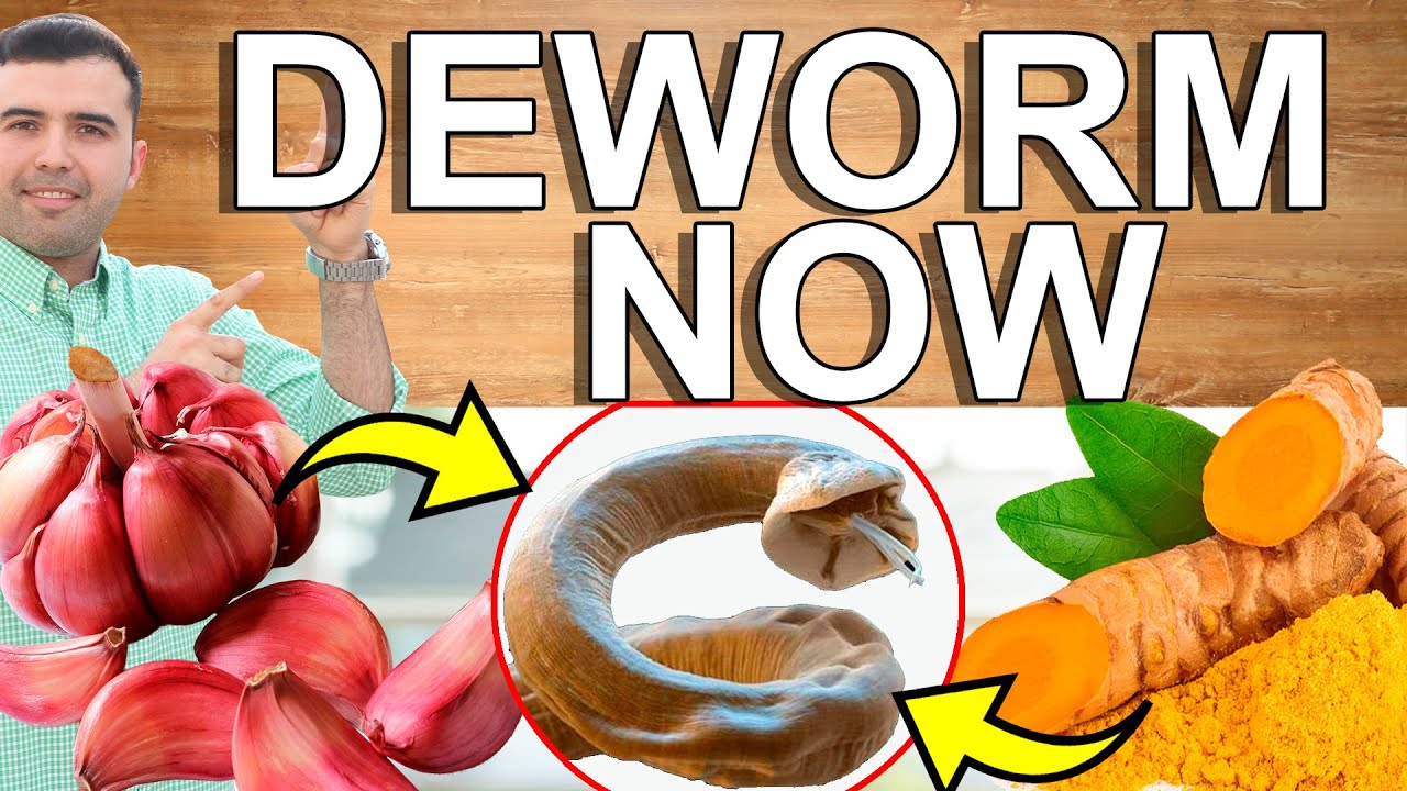 DEWORM NOW! &mdash; Как избавиться от паразитов дома &mdash; Домашние средства для очищения и детоксикации ки...