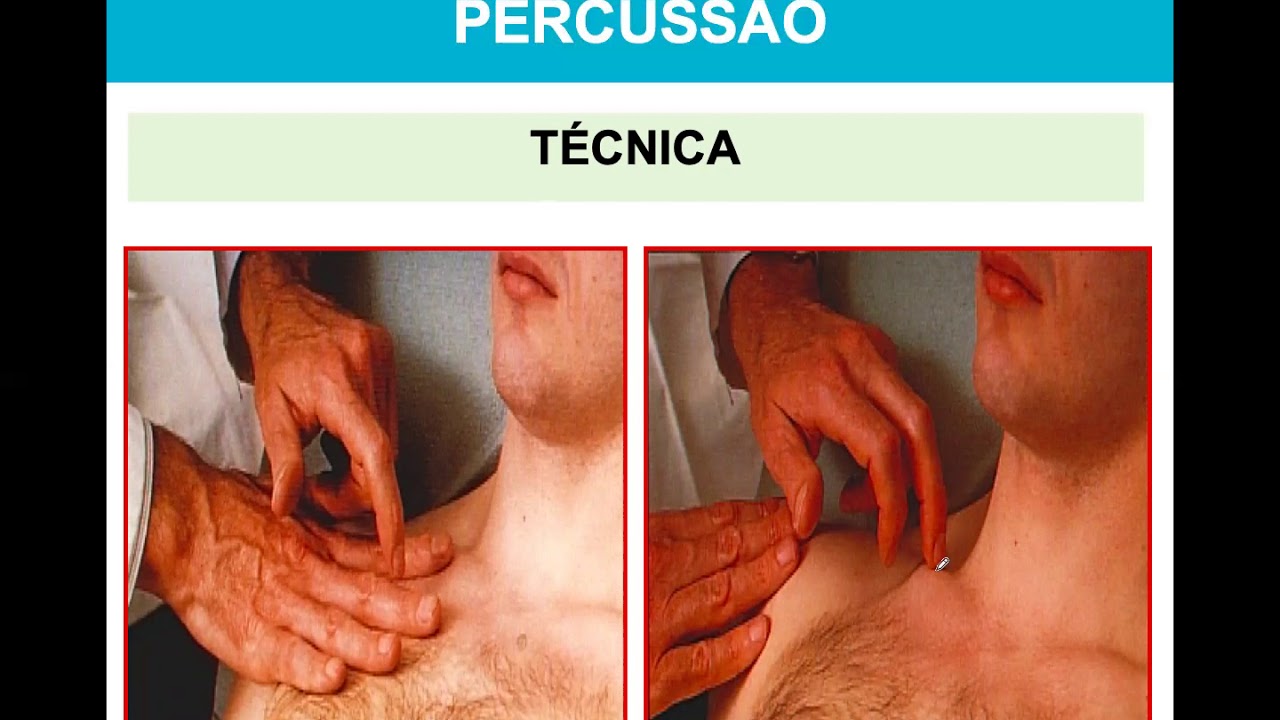 Avaliação/Exame Físico do Sistema Respiratório parte II - Profa Larissa Perez