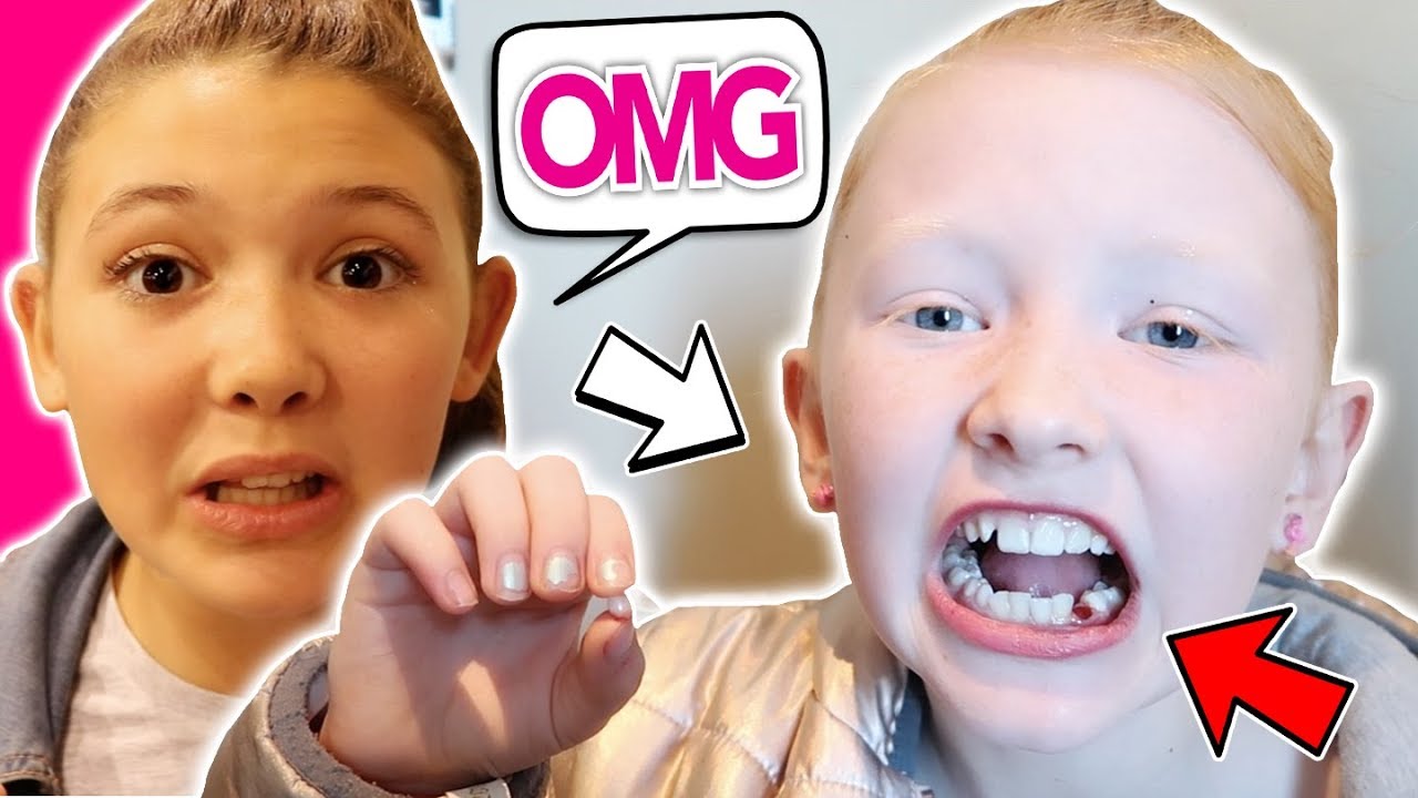 WHEN YOUR CHILD RIPS OUT HER OWN TOOTH!
