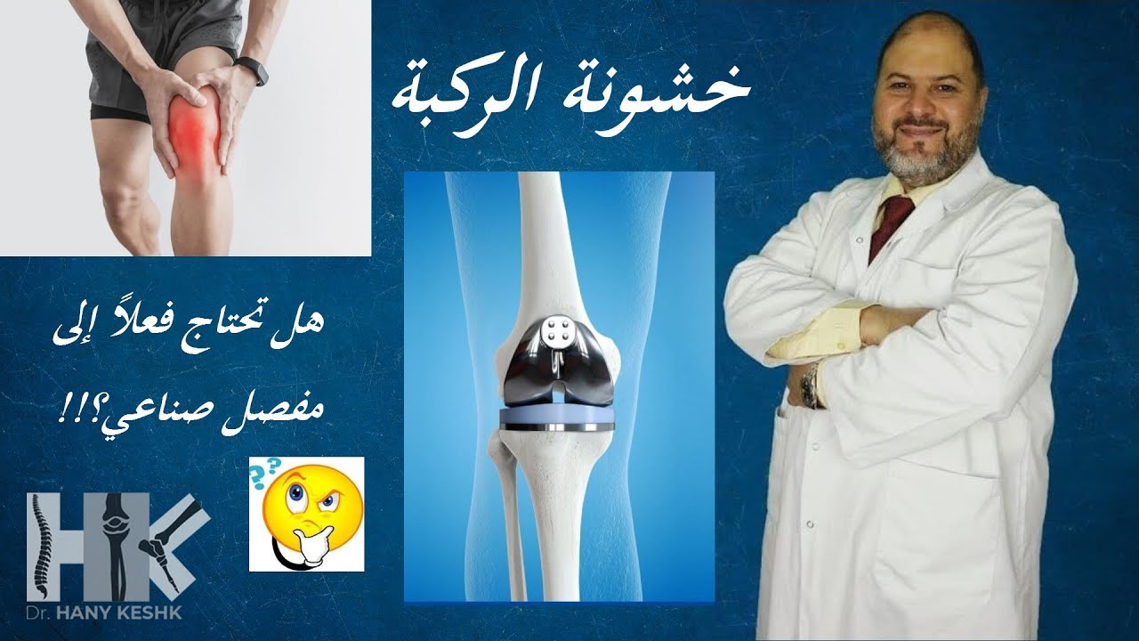 ومضات طبية:  خشونة الركبة وكلام مهم جداً لم تسمعه من قبل