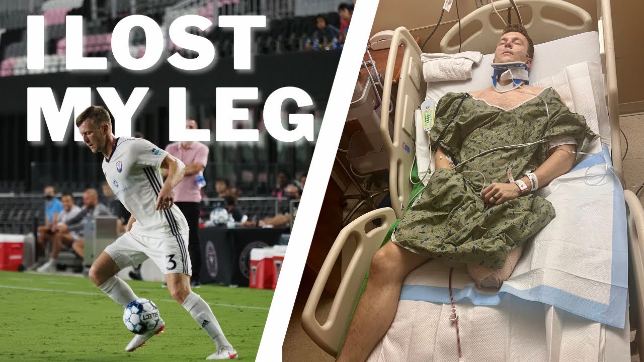 From Pro Athlete to Amputee | My Story