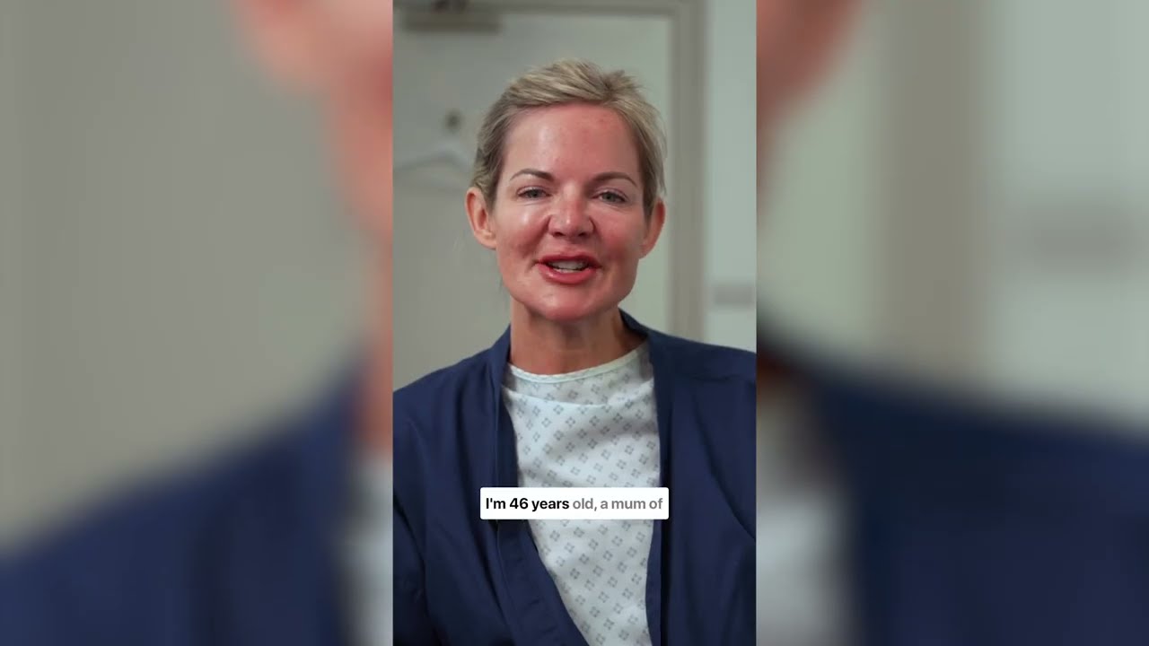 My Deep plane Facelift journey with Dr Georgios Orfaniotis, London, 2025