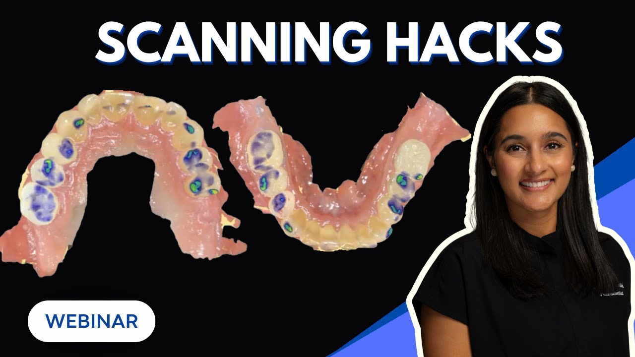 Scanning Hacks Every Dental Practice Should Know