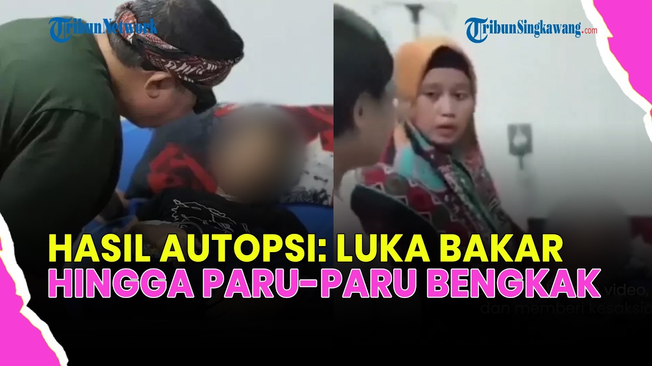 🔴KASUS BOCAH SUKABUMI, DOKTER FORENSIK UNGKAP TEMUAN AWAL