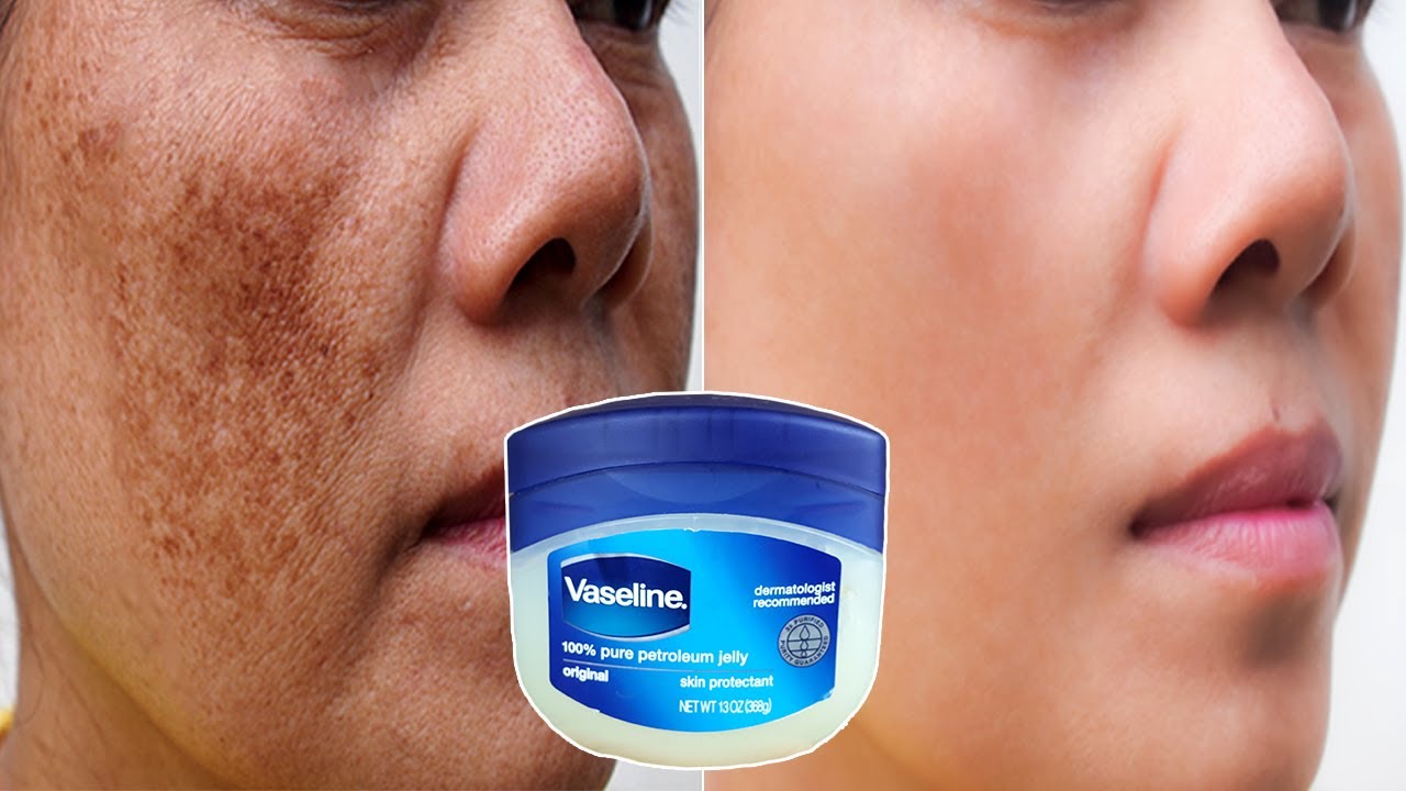 Voici Comment Utiliser La Vaseline & Le Citron Pour Enlever Les Rides & Les Taches Brunes De La Peau