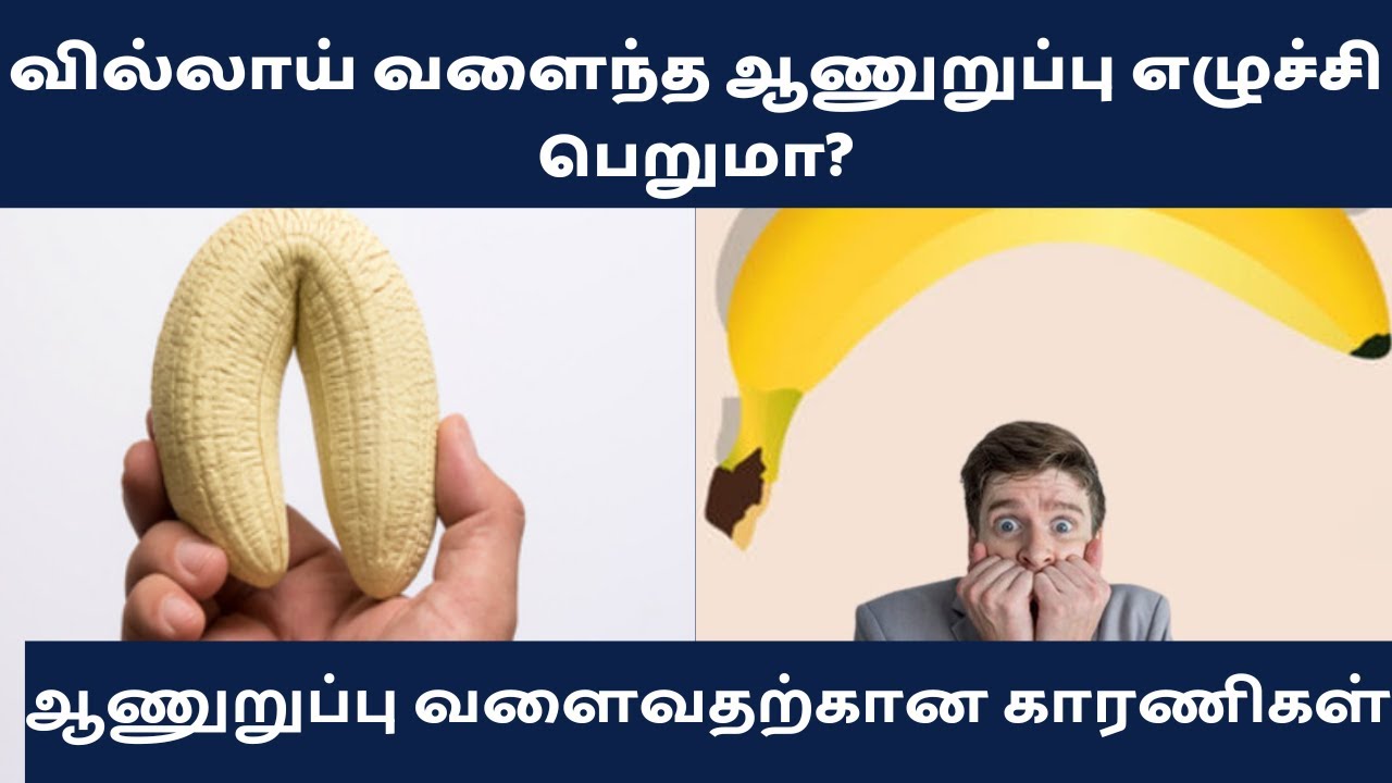 ஆணுறுப்பு வில்லாய் வளைந்து இருக்கிறது | ஆணுறுப்பு எழுச்சி| ஆணுறுப்பு வளைந்து இருப்பதற்கான காரணங்கள்