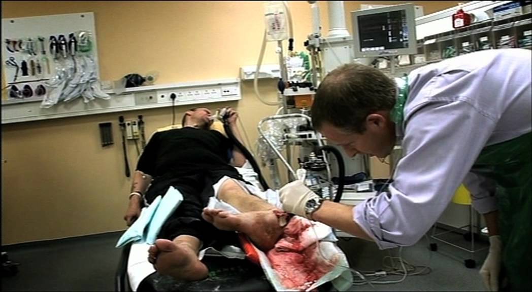 Worst Ankle Fracture (Part 1) - Bizarre ER
