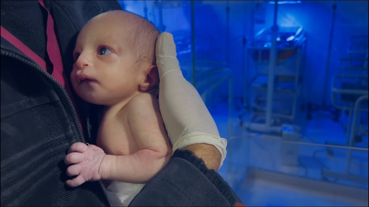 Cute Newborn Baby Update | Baby Is Improving Day by Day 👶💖