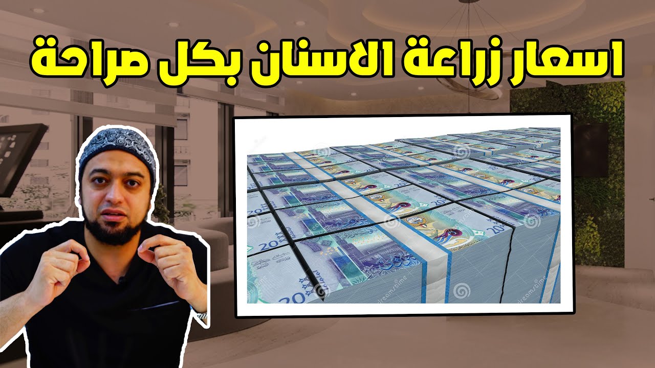 اسعار زراعة الاسنان بكل صراحة