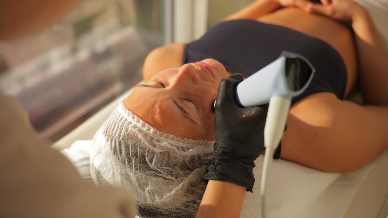 ¿Qué es Exion Face? Lifting facial sin Cirugía en NCA Chile