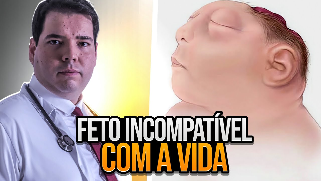 Malformação Fetal Grave - Feto Incompatível com a Vida