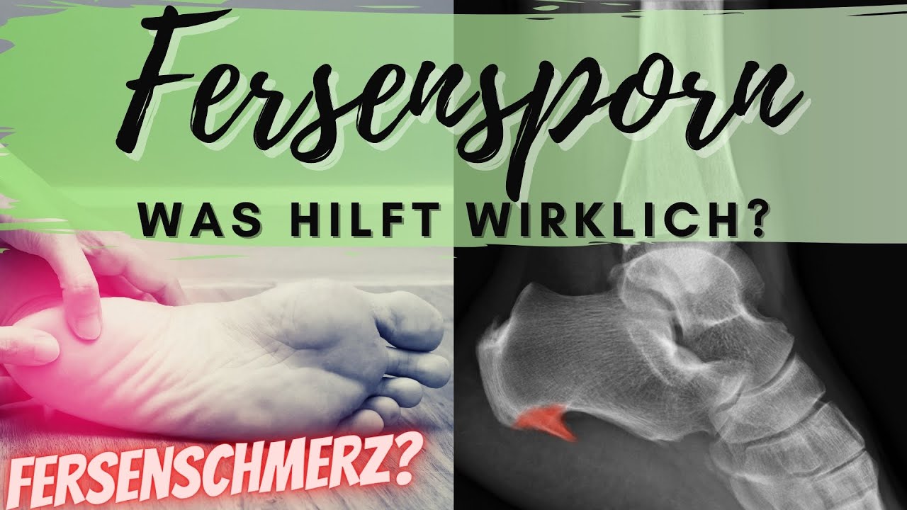 Fersensporn? Effektive Übungen bei Fersenschmerzen (Plantarfasziitis / Fersensporn)