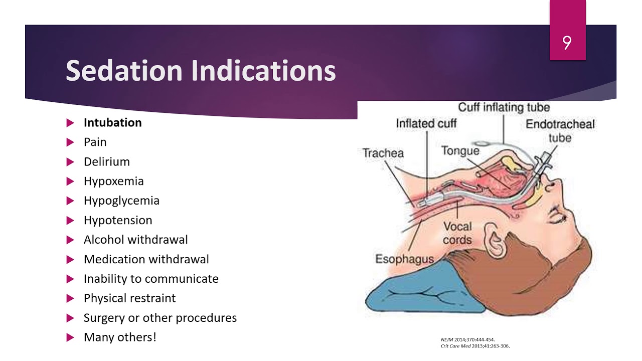 Sedation and Paralysis